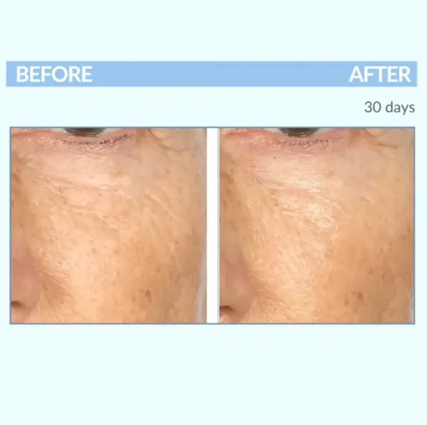 Advanced Eye Cream Concentrate