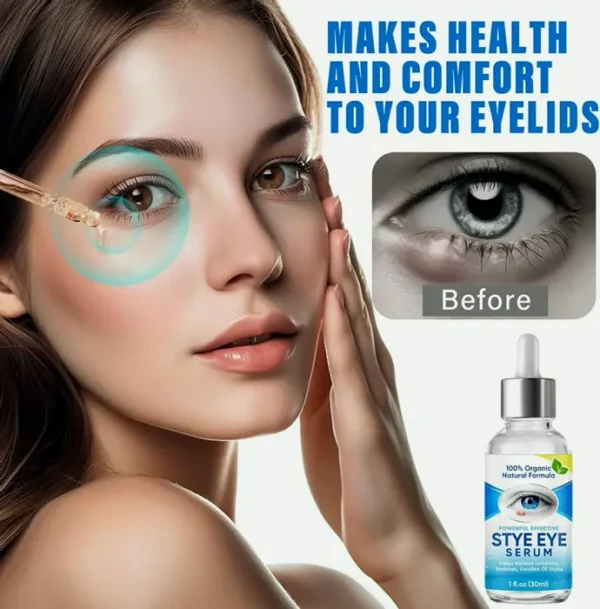 Styê Vision Treatment Drops for Fast Relief