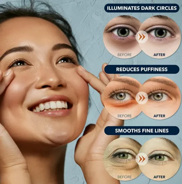 Pure-Derm Anti-Aging Eye Pads - 30 Sheets Pack