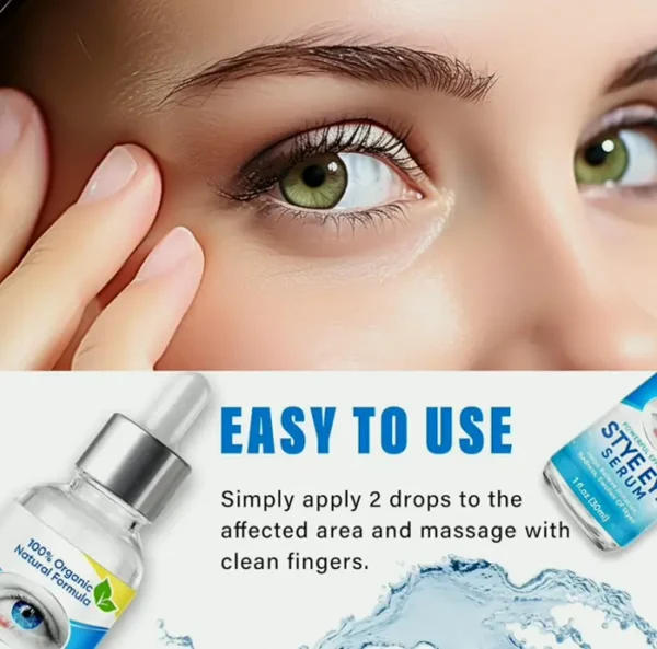 Styê Vision Treatment Drops for Fast Relief