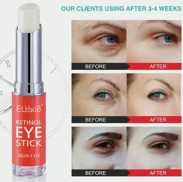 Anti-Wrinkle Eye Cream for Puffy Eyes and Shadowed Under-Eyes