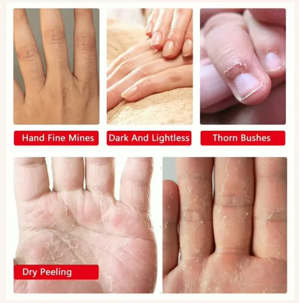 Set of 4 Hand Moisturizing Gloves for Cracked Skin