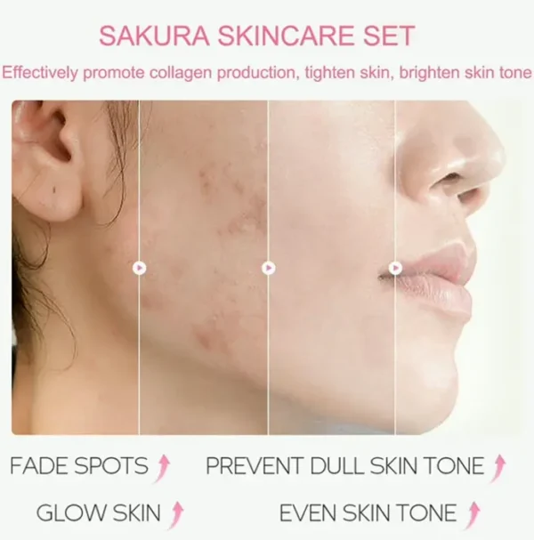 Face Skin Care Sets - Cherry Blossom Gift Set for Teenagers