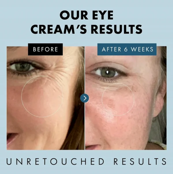 Eye Moisturizer for Puffiness and Wrinkles