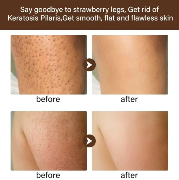 Strawberry Legs Care Lotion for Women