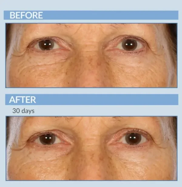 Advanced Eye Cream Concentrate