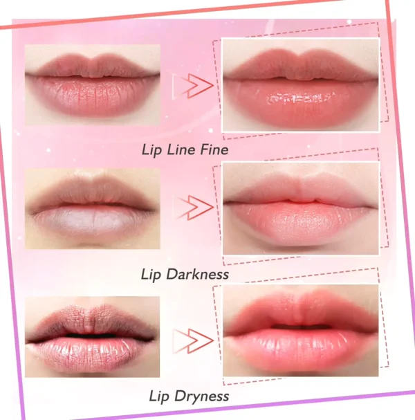 Collagen Lip Patches - Moisturize & Enhance